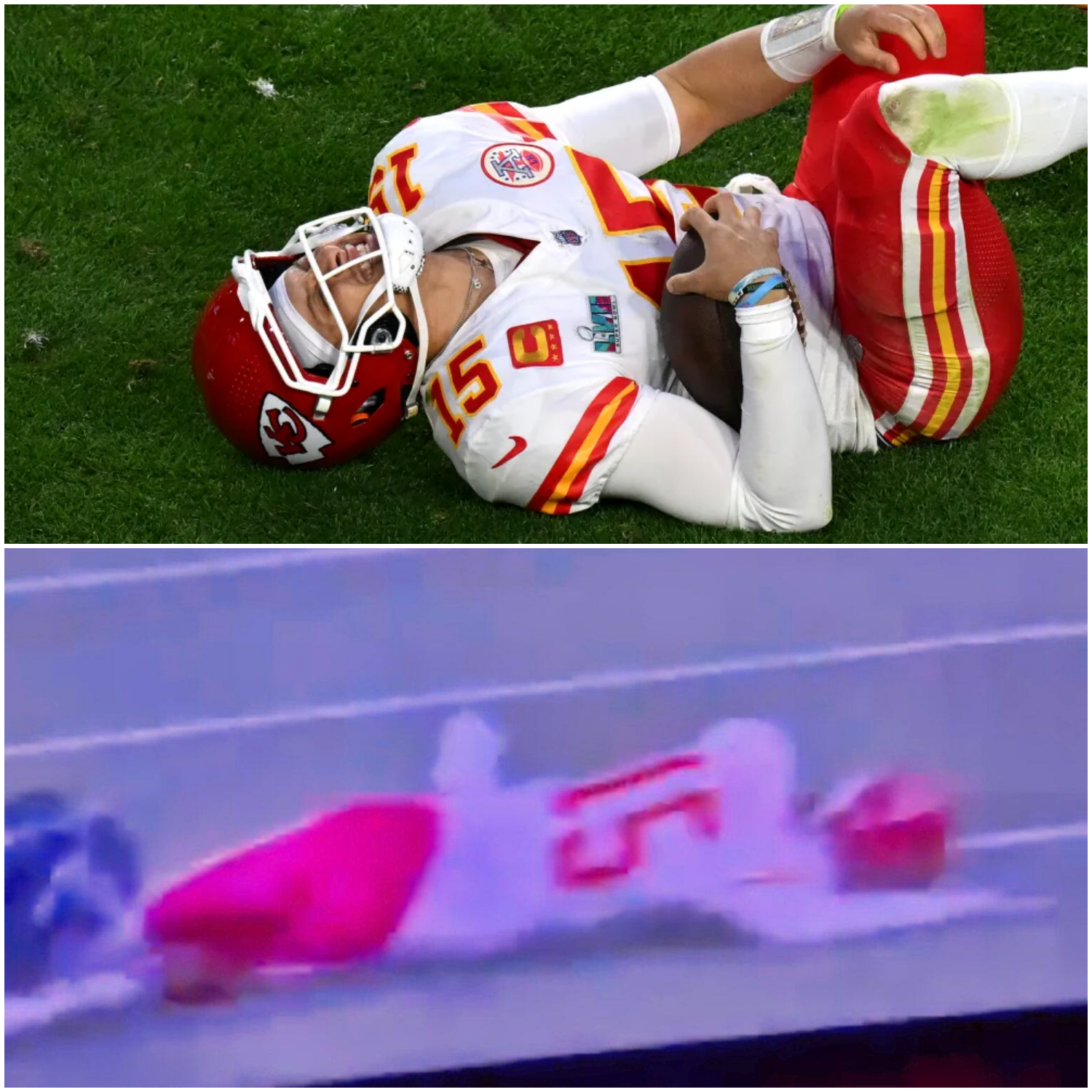 BREAKING: Patrick Mahomes suffered a serious knee injury that led to his poor performance at the Super Bowl. ts.dhung.