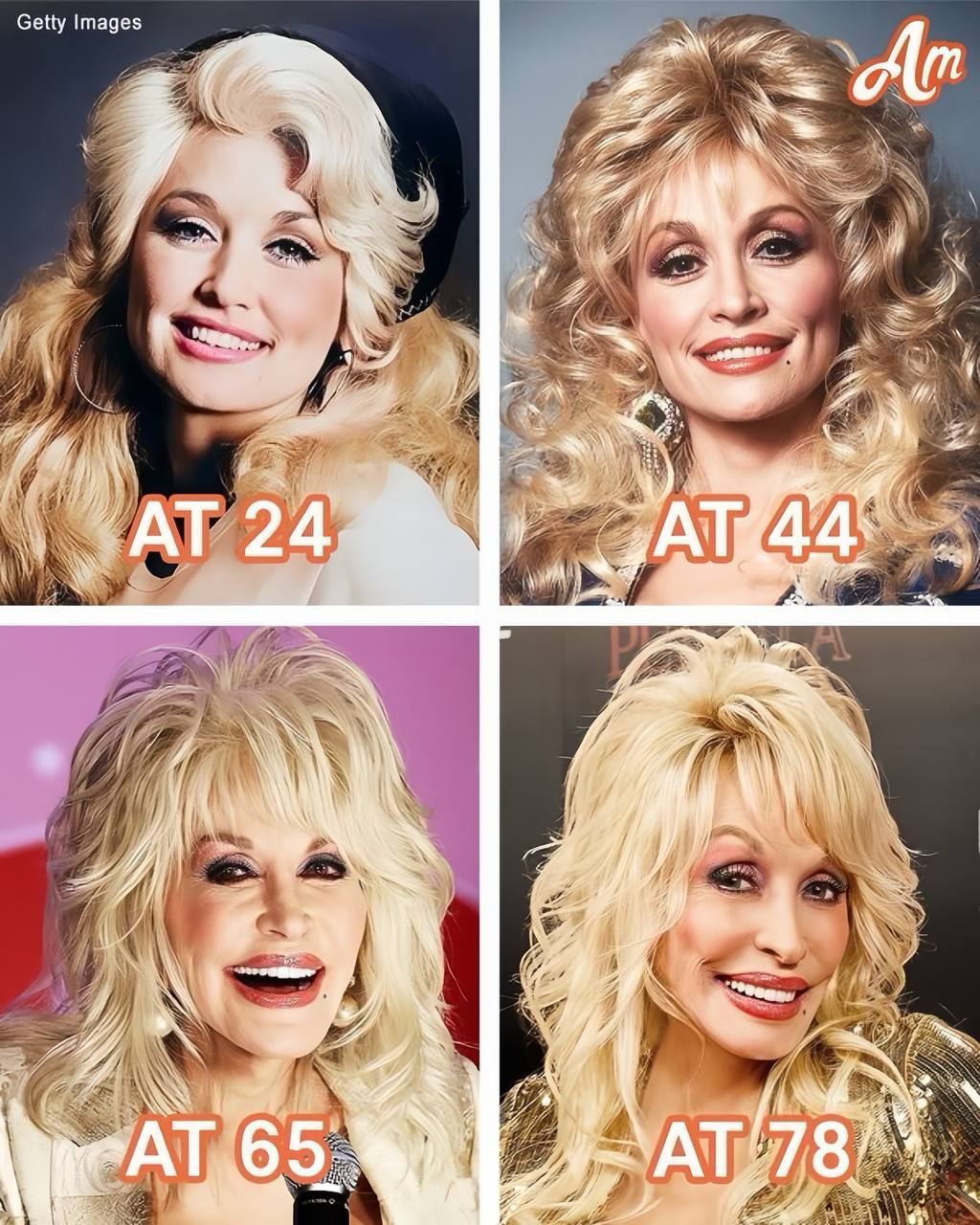 Cover Image for HOT NEWS: She Stopped Aging at 44? Dolly Parton’s Ageless Glow Through the Decades Has Fans Speechless!