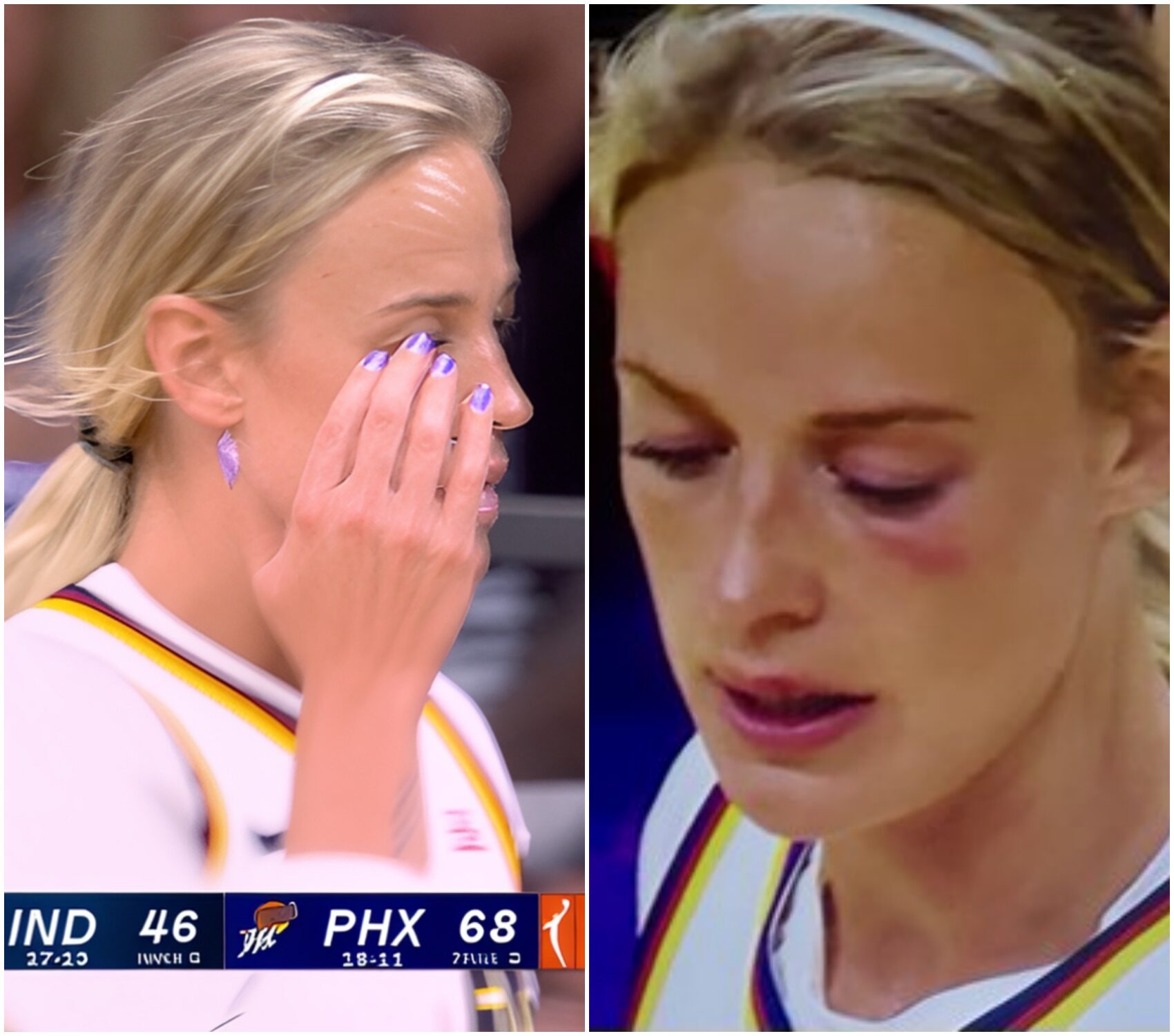 Cover Image for VIDEO: Sophie Cunningham had a fiery clash with former teammate DeWanna Bonner, leaving her with a black eye after a dirty fight during the Mercury vs. Fever game.