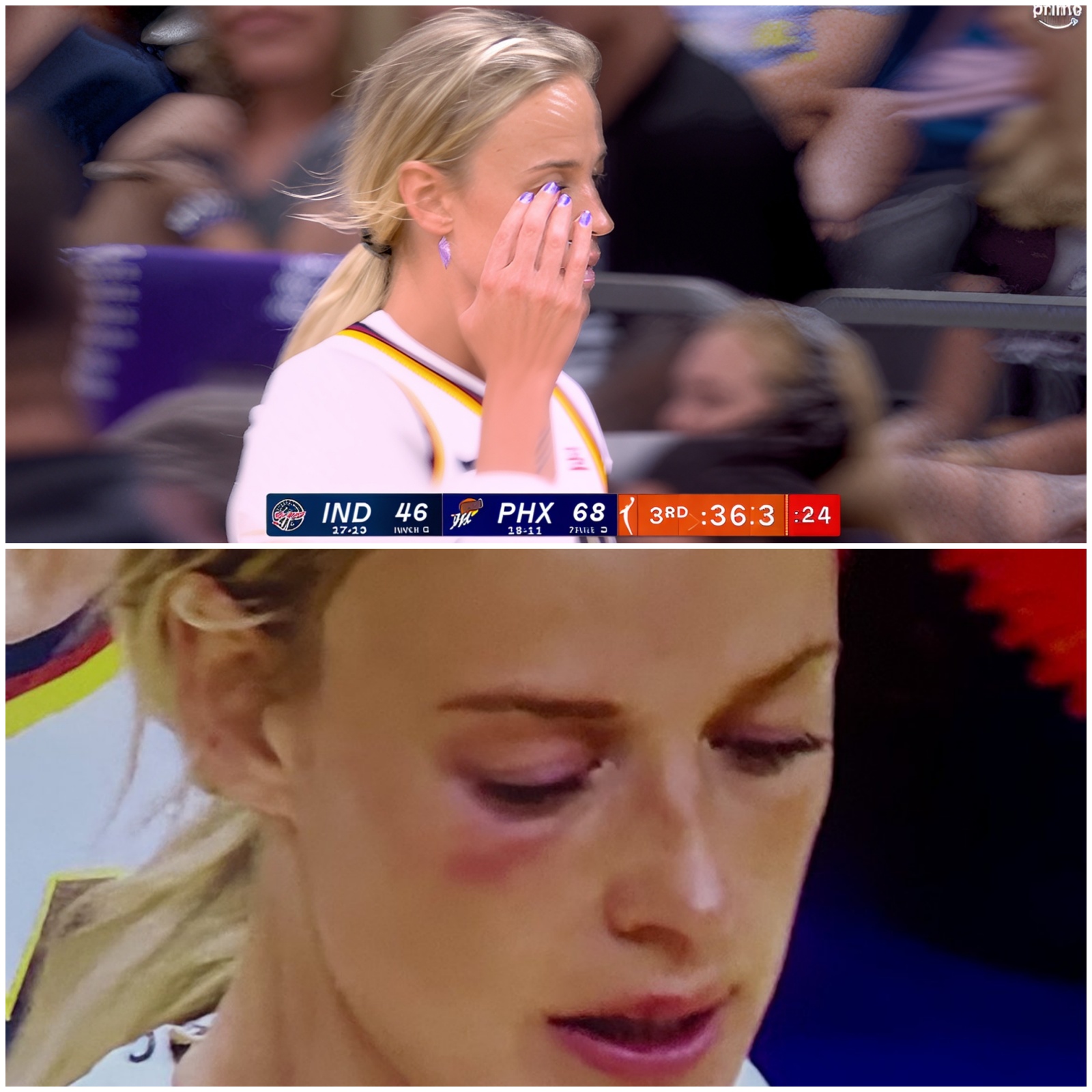Cover Image for VIDEO: Social Media Detectives Noticed Sophie Cunningham Had A Black Eye During Her Return To Phoenix, After Getting Nailed By S*x Toy