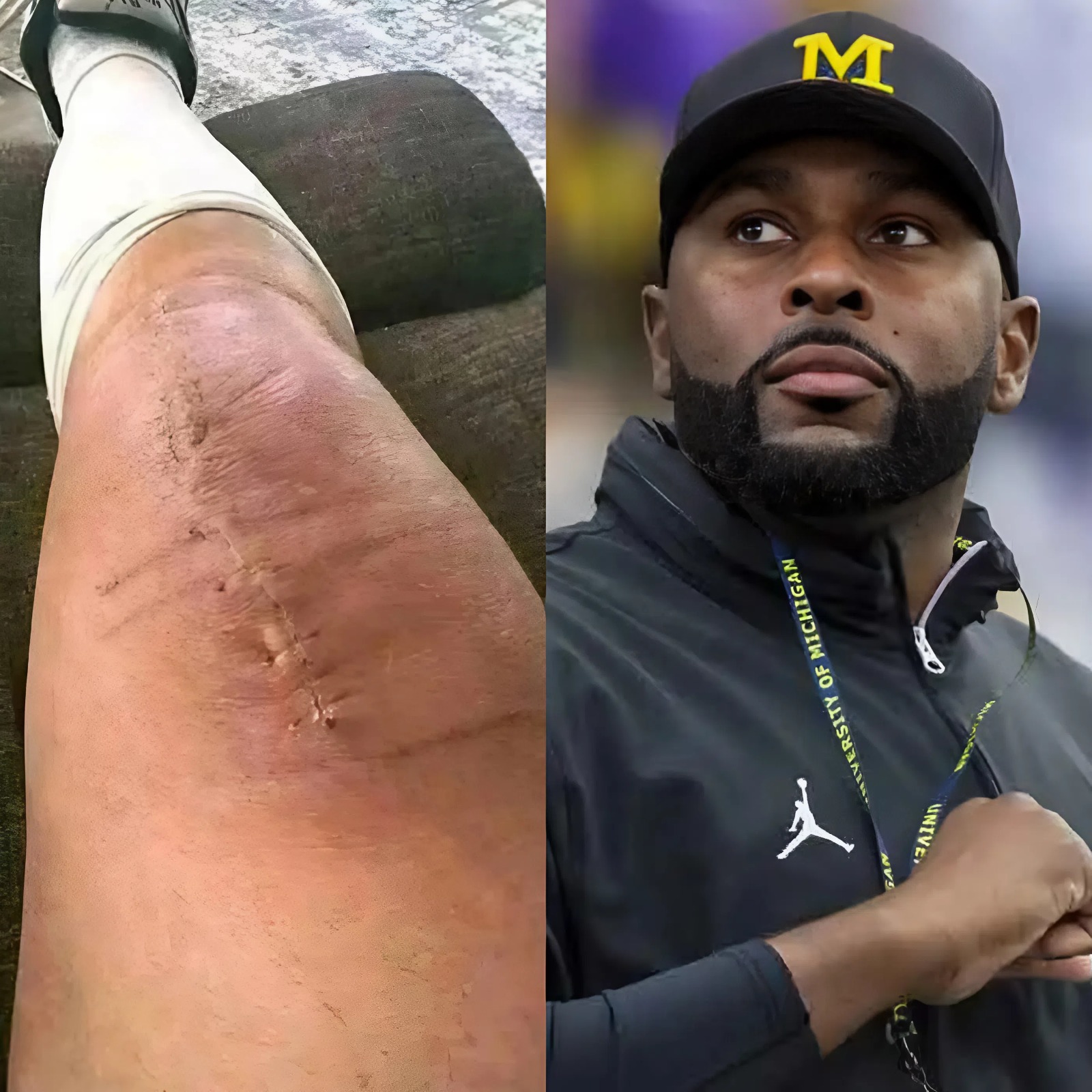 Cover Image for After weeks of silence, Moore has spoken, offering reassurance while admitting the journey ahead won’t be easy. The surgery is behind him, but he emphasized: “I’m fighting, but I can’t do this alone.”