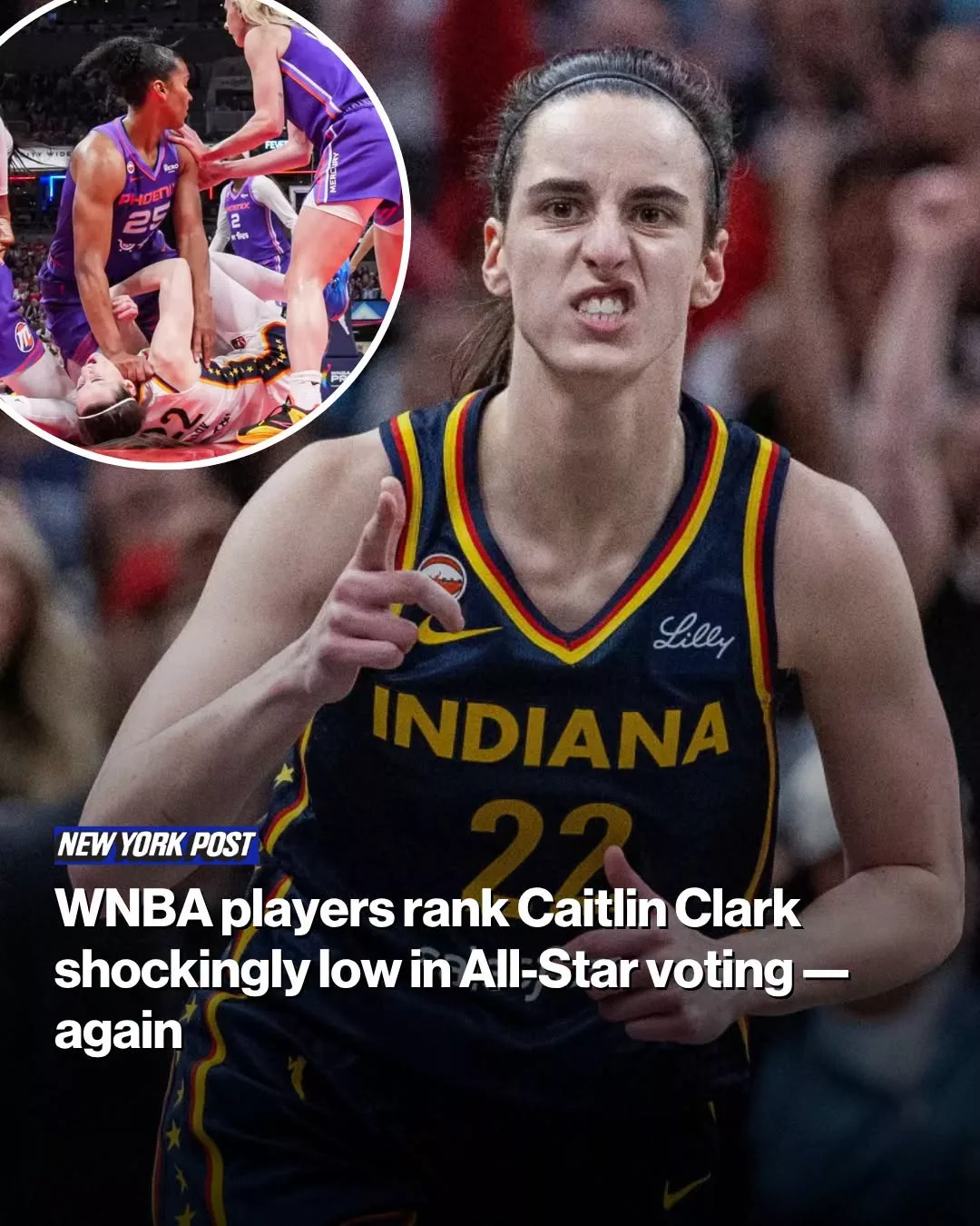 Cover Image for The snubs have reached a fever pitch.