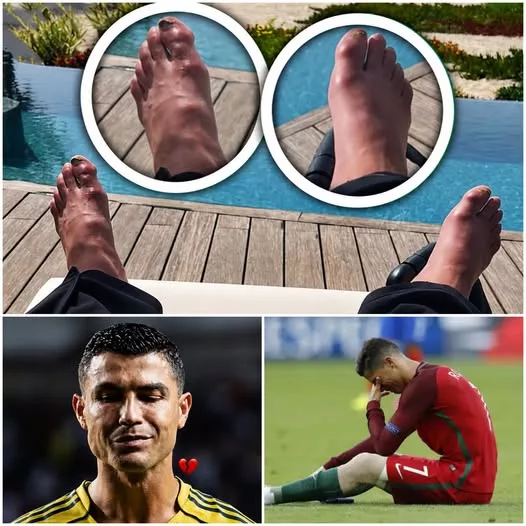 Cover Image for 🚨🔥 CRISTIANO RONALDO DEIXA UMA FRASE QUE ESTÁ A INTRIGAR O MUNDO: “ESTOU MUITO CURIOSO PARA VER O QUE AS MINHAS PERNAS AINDA ME VÃO PROPORCIONAR…” Cristiano Ronaldo voltou a falar sobre o futuro — e as suas palavras estão a fazer milhões de fãs pensar no que poderá acontecer a seguir. 😱⚽ O português admitiu que já não pensa tão longe como antigamente e revelou que encara agora o objetivo dos 1.000 golos de uma forma mais tranquila. Mas foi outra frase que chamou especialmente a atenção: o que ainda poderão fazer as pernas que sustentaram 25 anos de sacrifício, treino e dedicação? Será que Ronaldo ainda prepara mais um capítulo histórico? 👀 O próximo desafio do craque português pode ser muito mais surpreendente do que imaginamos…