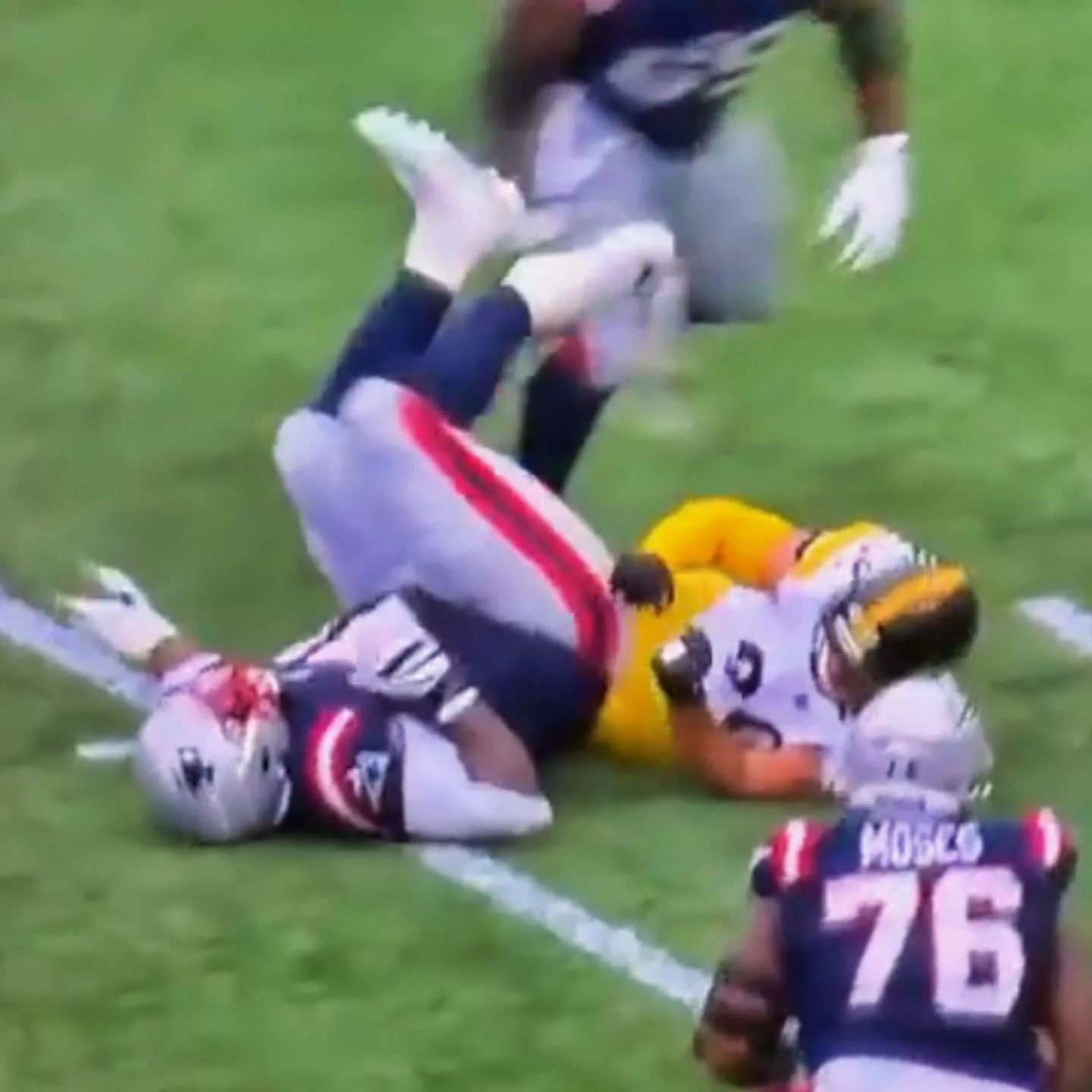 Cover Image for Patriots Superstar Mike Onwenu Has His Leg Snapped In Half — Carted Off Field In Nightmare Scene [VIDEO]